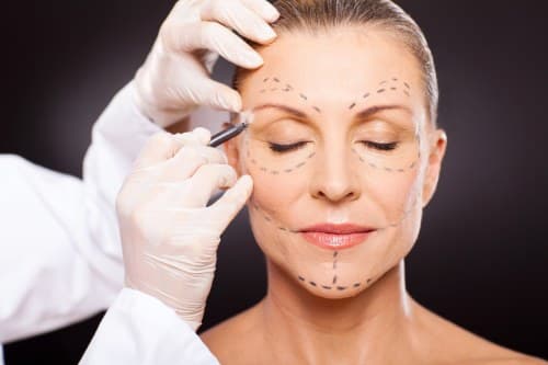 AccuTite – minimally invasive radiofrequency lifting for small areas
