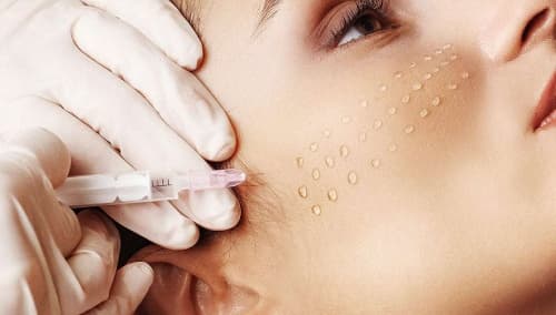 Mesotherapy for nourishing and refreshing the skin