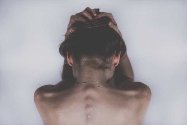 Seborrheic keratosis treatment