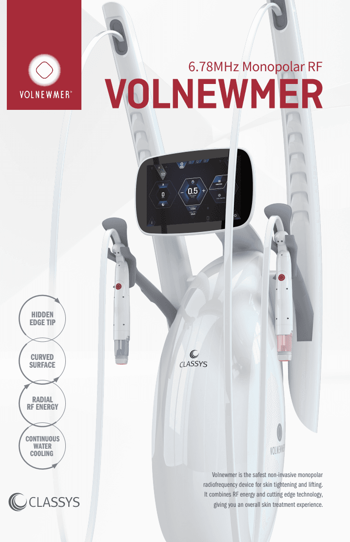 Как работи Volnewmer?