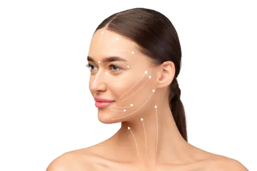 Thread lifting – lifting and tightening of the face