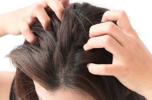 Itchy scalp