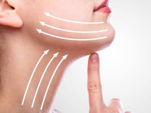 Lifting procedures for facial tightening