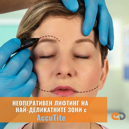 AccuTite non-surgical lifting treatment for delicate facial areas