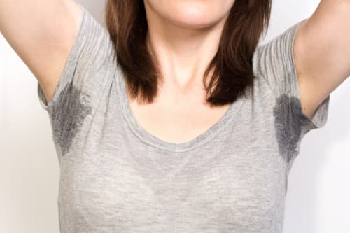 Hyperhidrosis – treatment of excessive sweating