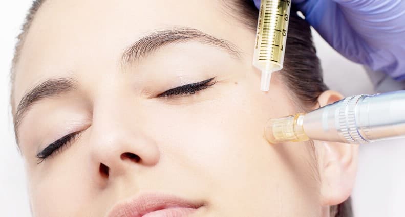 Mesotherapy treatment for the face and hair