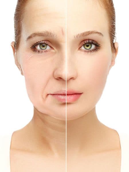 Non-surgical facial rejuvenation result