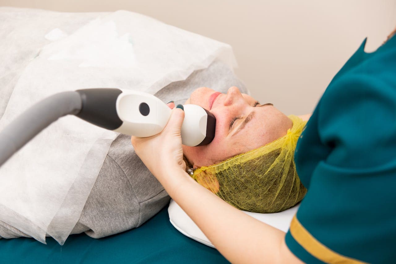 What microneedling is and its benefits for the skin