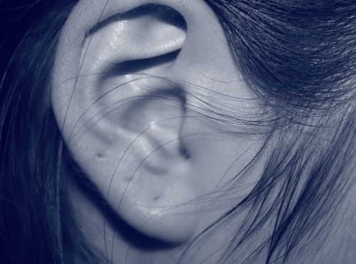 Otoplasty – surgical correction of the ears
