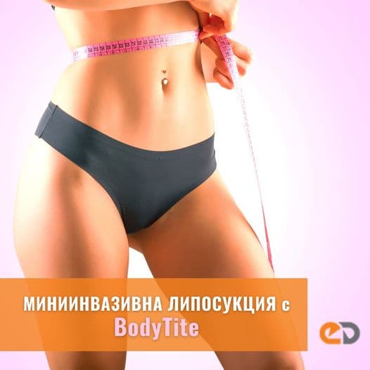 BodyTite minimally invasive liposuction procedure